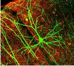 La mort de la mort. Lettre de juillet 2013. Numéro 52