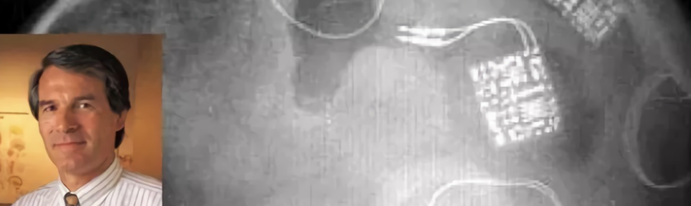 « LE NEUROLOGUE QUI A « HACKÉ » SON CERVEAU ET A FAILLI PERDRE LA TÊTE »