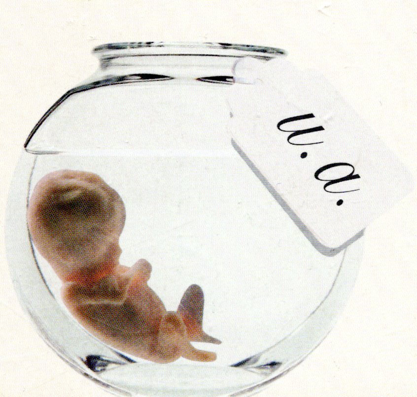 Notes de lecture sur : L’utérus artificiel, de Henri Atlan